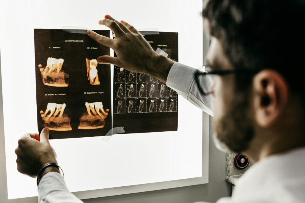 AI in healthcare